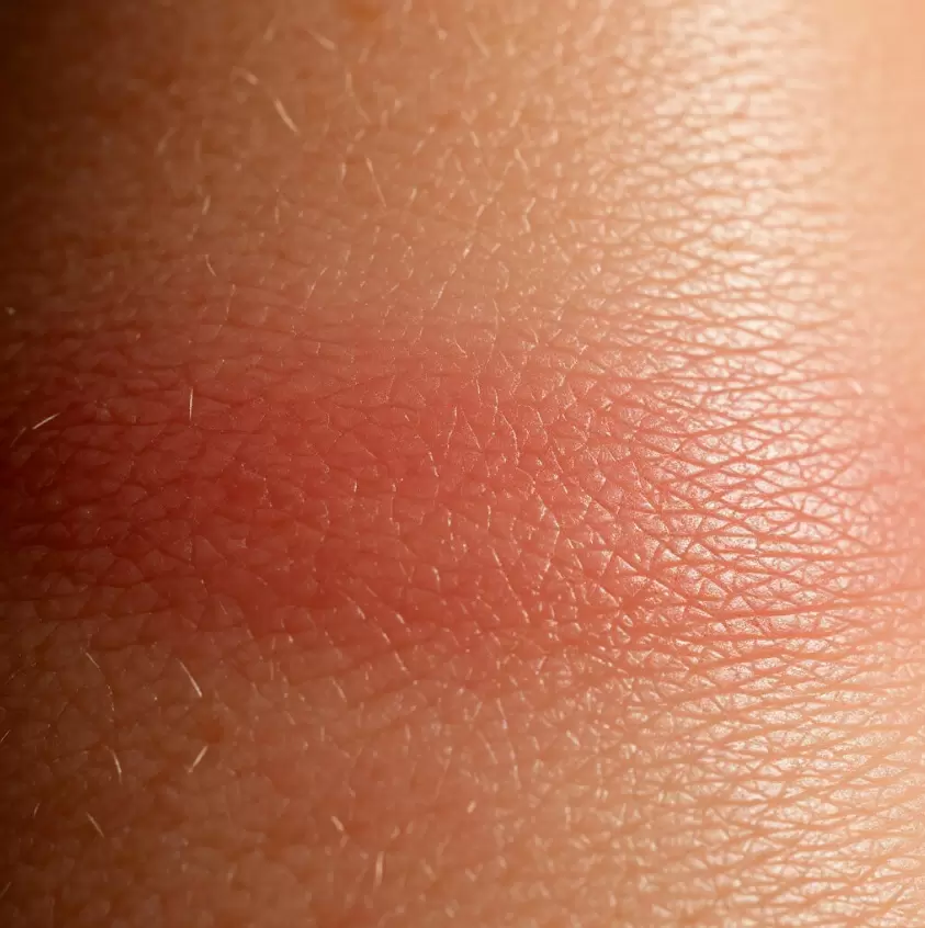 Как эмоции отражаются на состоянии нашей кожи